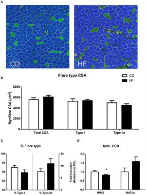 Maternal High Fat Diet Alters Skeletal Muscle Mitochondrial Catalytic Activity in Adult Male Rat Offspring